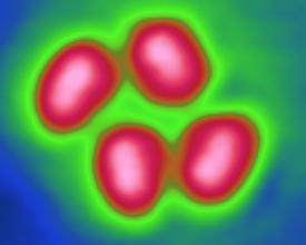 自動定量粉劑包裝機包裝精度第4篇：物料的粘結性對包裝精度的影響